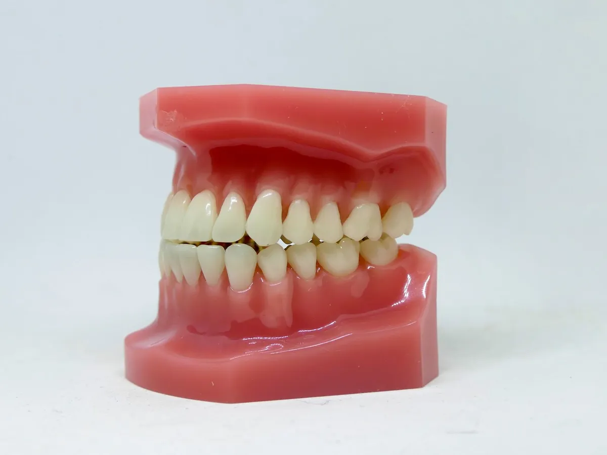Tratamento periodontal
